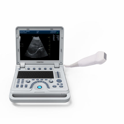 CMS1700B Portable Color Doppler Ultrasound Scanner Cardiology System With Probe