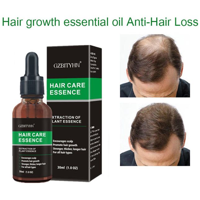 Peekaboo Studio Hair Growth Oil - Nourishing & Strengthening Formula