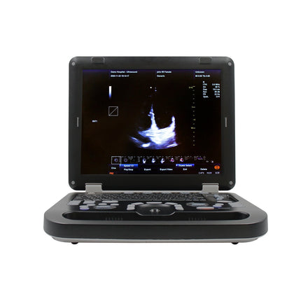 CMS1700CVET Portable Color Doppler Veterinary Ultrasound Scanner with Probe