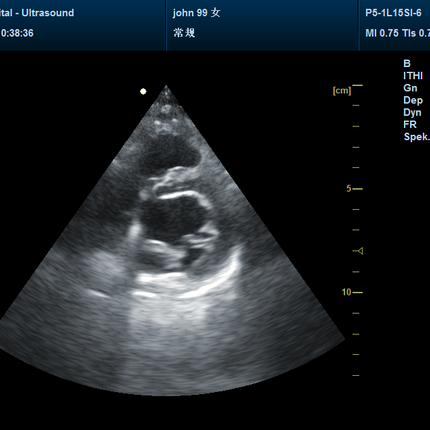 CMS1700B-VET Portable Color Doppler Ultrasound Scanner for Veterinary Use