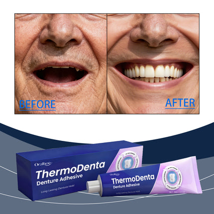 Très Elite Permanent Denture Adhesive - Strong Hold, Waterproof Formul