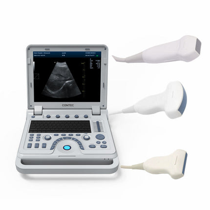 CMS1700B Portable Color Doppler Ultrasound Scanner Cardiology System With Probe