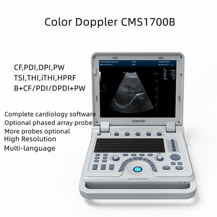 CMS1700B Portable Color Doppler Ultrasound Scanner Cardiology System With Probe