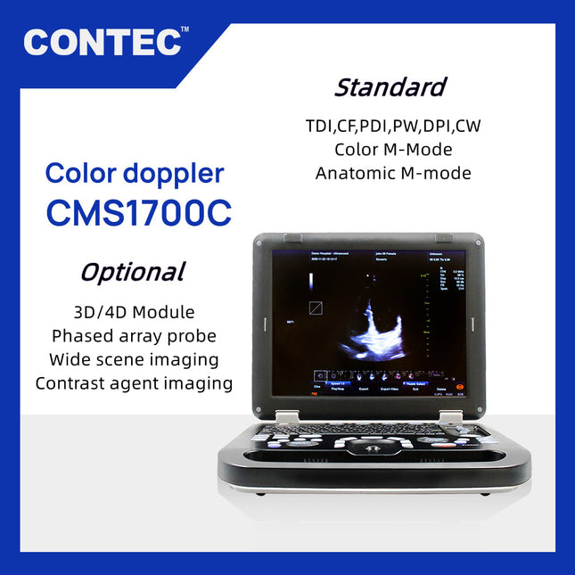CMS1700C Color Doppler Portable Ultrasound Scanner With Probe