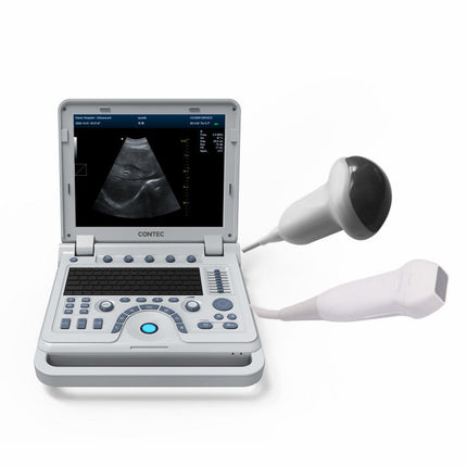 CMS1700B Portable Color Doppler Ultrasound Scanner Cardiology System With Probe