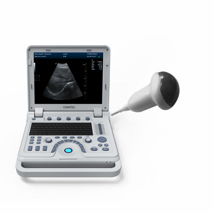 CMS1700B Portable Color Doppler Ultrasound Scanner Cardiology System With Probe