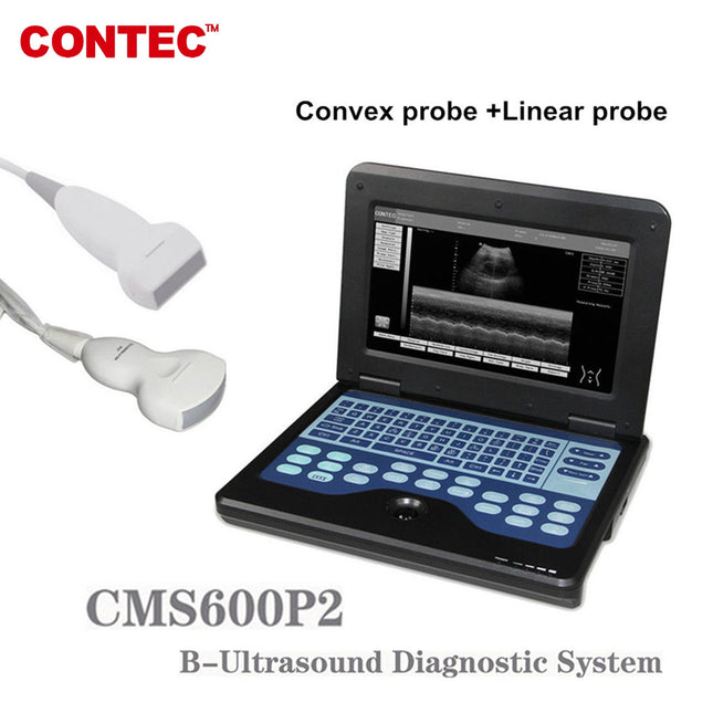 CMS600P2 Portable Ultrasound Scanner with 7.5M Linear and 3.5M Convex Probes