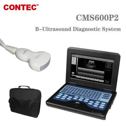 Contec CMS600P2 Portable Laptop Digital Ultrasound Scanner 3.5 Convex Probe