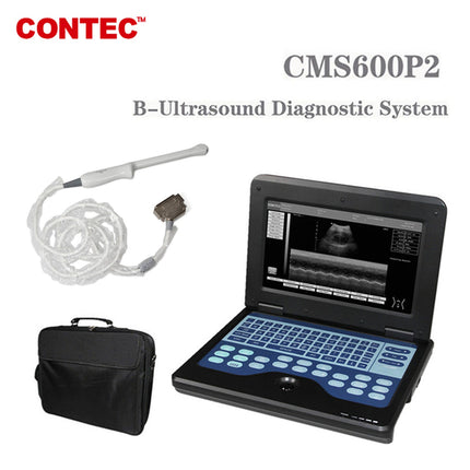 Contec Portable Laptop Ultrasound Scanner With 6.5 MHz Endovaginal Probe CMS600P2