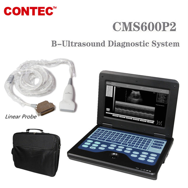 CONTEC CMS600P2 Portable Laptop Ultrasound Scanner With 7.5MHz Linear Probe