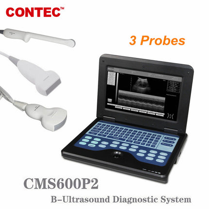CMS600P2 Portable Digital Ultrasound Scanner Convex Linear Transvaginal Probes