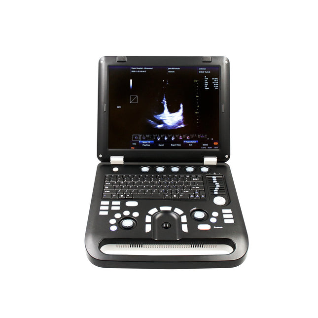 CMS1700CVET Portable Color Doppler Veterinary Ultrasound Scanner with Probe