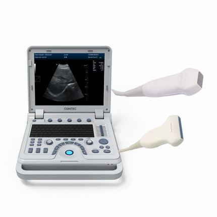 CMS1700B Portable Color Doppler Ultrasound Scanner Cardiology System With Probe