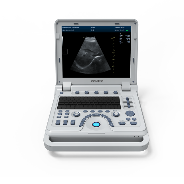 CMS1700B-VET Portable Color Doppler Ultrasound Scanner for Veterinary Use