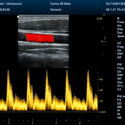 CMS1700B-VET Portable Color Doppler Ultrasound Scanner for Veterinary Use