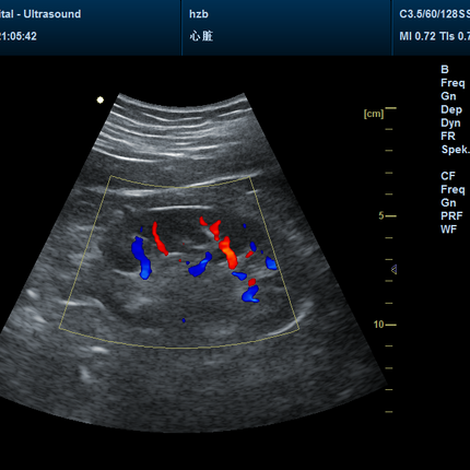 CMS1700B Portable Color Doppler Ultrasound Scanner Cardiology System With Probe