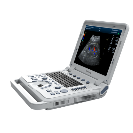 CMS1700B-VET Portable Color Doppler Ultrasound Scanner for Veterinary Use