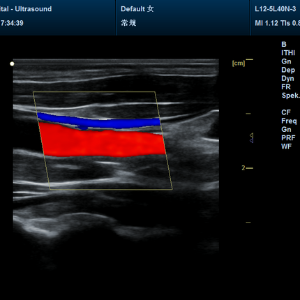 CMS1700CVET Portable Color Doppler Veterinary Ultrasound Scanner with Probe