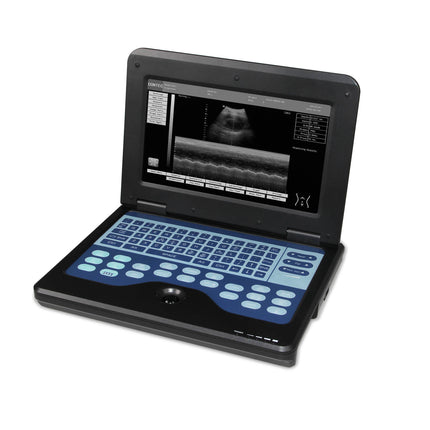 Contec Portable Laptop Ultrasound Scanner With 6.5 MHz Endovaginal Probe CMS600P2