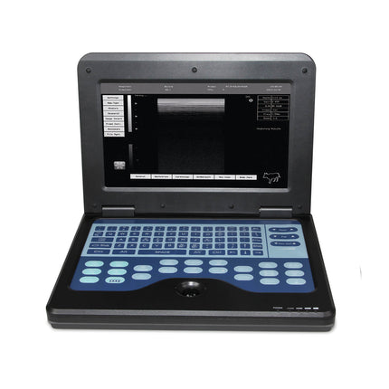 Contec CMS600P2 Portable Laptop Digital Ultrasound Scanner 3.5 Convex Probe