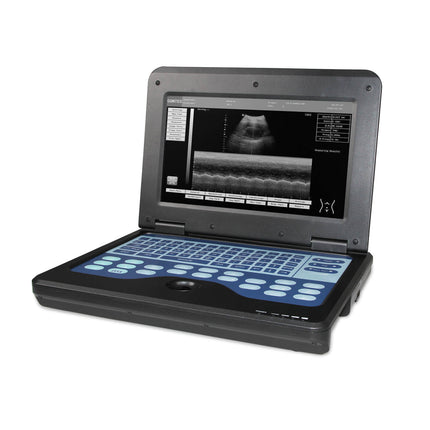 Contec CMS600P2 Portable Laptop Digital Ultrasound Scanner 3.5 Convex Probe