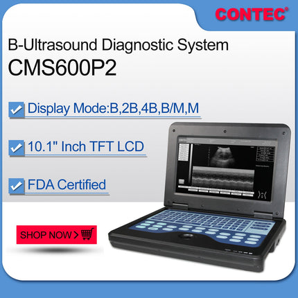 Contec CMS600P2 Portable Laptop Digital Ultrasound Scanner 3.5 Convex Probe
