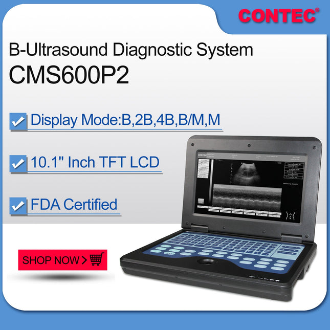 Contec CMS600P2 Portable Laptop Digital Ultrasound Scanner 3.5 Convex Probe