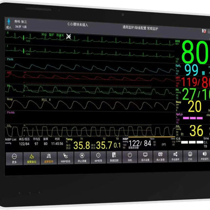 CONTEC CMS8500 14-Inch Touchscreen Vital Signs Monitor - Advanced 6 Parameter Monitoring with Optional ETCO2 - Très Elite