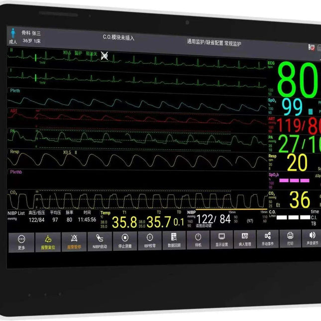 CONTEC CMS8500 14-Inch Touchscreen Vital Signs Monitor - Advanced 6 Parameter Monitoring with Optional ETCO2