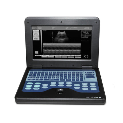 CONTEC CMS600P2 Portable Laptop Ultrasound Scanner With 7.5MHz Linear Probe