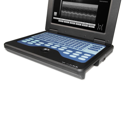 CMS600P2 Portable Ultrasound Scanner with 7.5M Linear and 3.5M Convex Probes