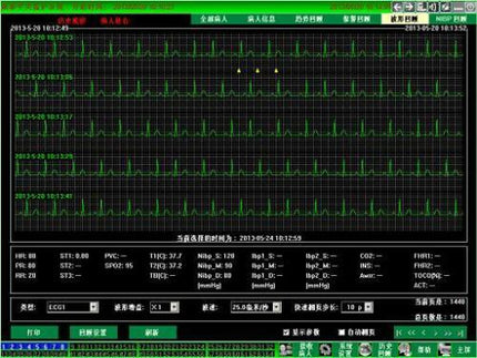 CONTEC Central Monitoring System Networked to CONTEC Patient Monitors