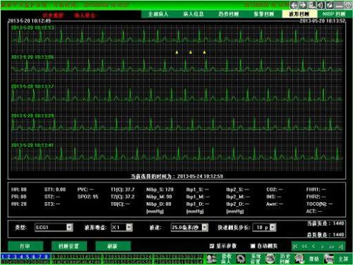 CONTEC Central Monitoring System Networked to CONTEC Patient Monitors