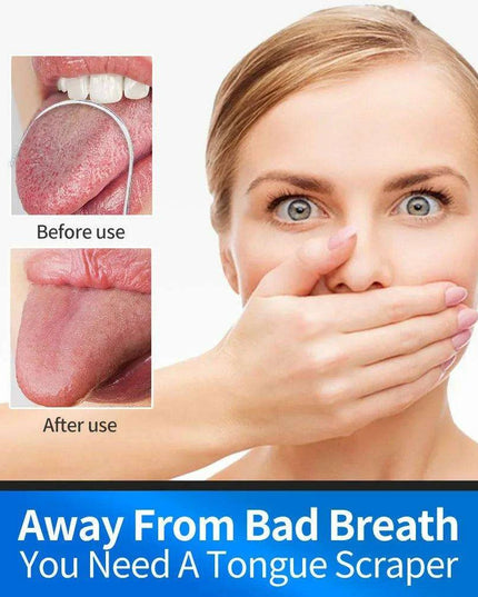 Stainless Steel Tongue Scraper