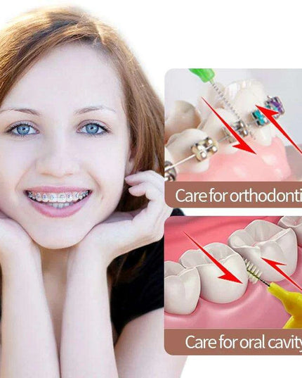 Pack Interdental Brushes for Adults - Flossing Tool for Dental Care and Orthodontics (0.6-1.0 mm)
