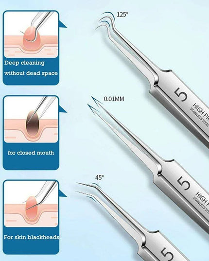 Ultra-Precision Blackhead Extractor: Advanced German Engineering for Radiant Skin