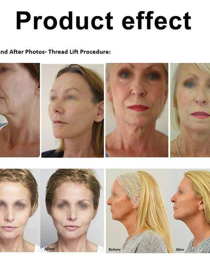 Youthful Glow Collagen Lift Threads Kit – At-Home Non-Invasive Skin Tightening Treatment for Radiant Skin