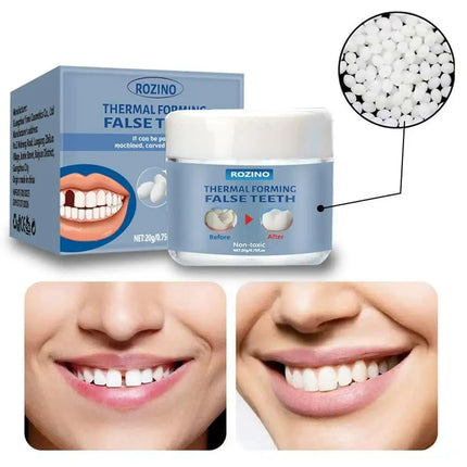 Sanwu Moldable False Teeth Kit - Temporary Tooth Filling & Whitening