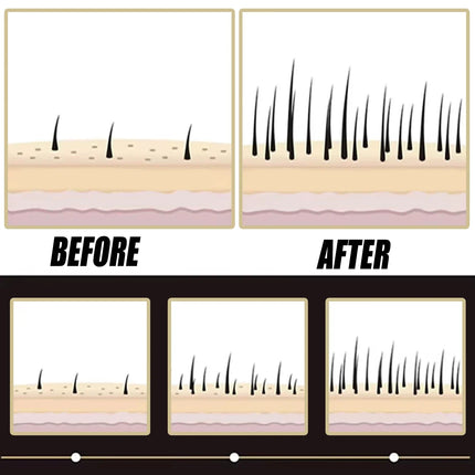Shop1105213665 Anti-Hair Loss Essence - Promotes Growth & Scalp Health