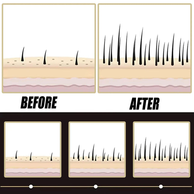 Anti-Hair Loss Scalp Essence — Hair Growth Support & Scalp Care Formula
