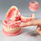 Moldable Silicone Denture Set, Upper & Lower Natural Ivory False Teeth Kit, Instant Smile with Free Toothbrush & Toothpaste moldable-silicone-denture-set-upper-lower-natural-ivory-false-teeth-kit-instant-smile-with-free-toothbrush-toothpaste