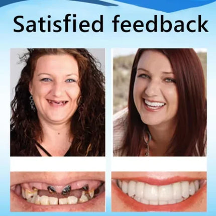 Boil-to-Shape Custom Fit Denture Kit — Slim Comfort Design, All Arch Sizes