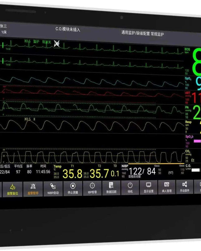 CONTEC CMS8500 14-Inch Touchscreen Vital Signs Monitor - Advanced 6 Parameter Monitoring with Optional ETCO2