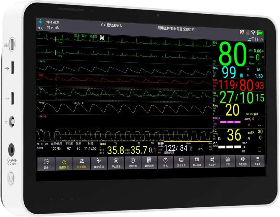 CONTEC CMS8500 14-Inch Touchscreen Vital Signs Monitor - Advanced 6 Parameter Monitoring with Optional ETCO2