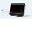 CONTEC CMS8500 14-Inch Touchscreen Vital Signs Monitor - Advanced 6 Parameter Monitoring with Optional ETCO2