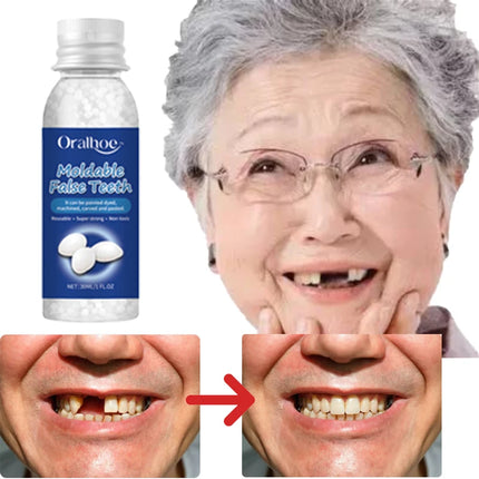 Resin Dental Adhesive — Shapeable Temporary Tooth Repair, Multi-Pack Options