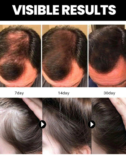 Nourishing Batana Oil for Optimal Hair Growth and Repair - Deep Hydration & Quality Enhancement