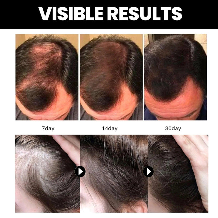 Nourishing Batana Oil for Optimal Hair Growth and Repair - Deep Hydration & Quality Enhancement