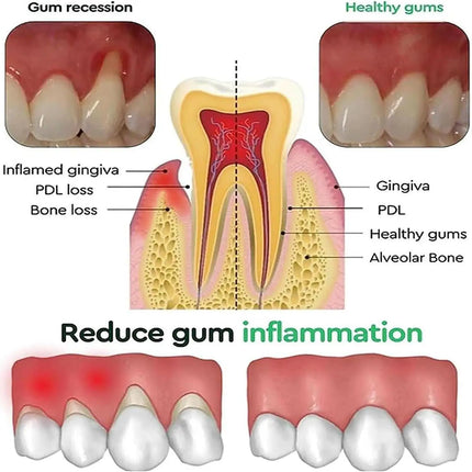 Shop1102921489 Damaged Gum Repair Care Gel Serum - Relieves Sore Gums