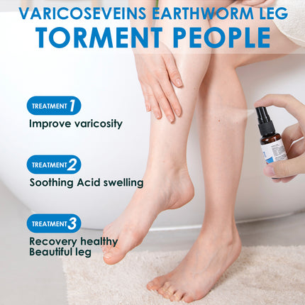 VeinCare 30ml Varicose Vein Spray - Promotes Blood Circulation & Comfo